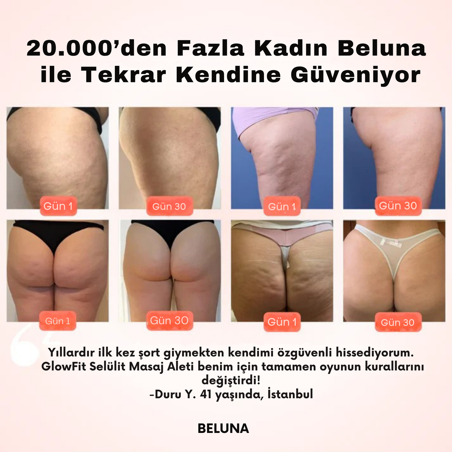 Beluna™ Selülit Masaj Aleti